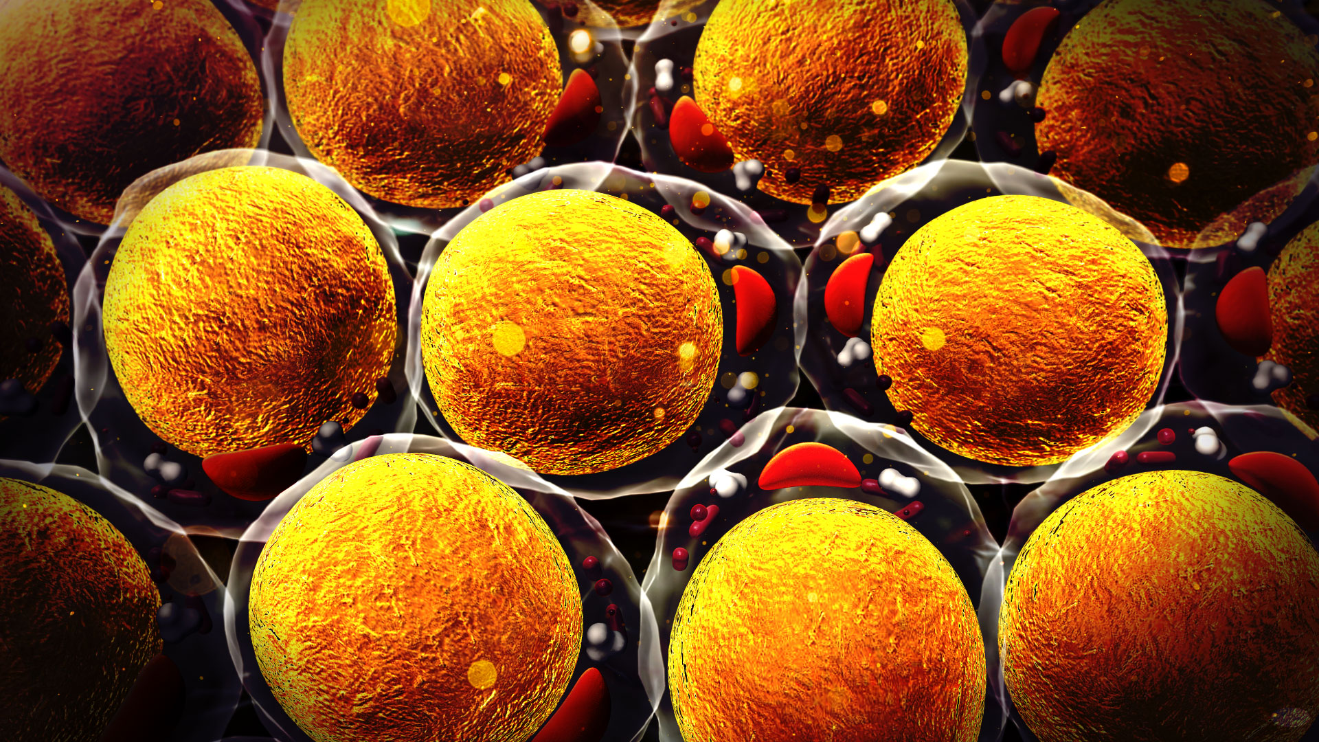 Asociación entre ingesta de ácidos grasos poliinsaturados n3 (N3- PUFAs) con el riesgo de cáncer de mama