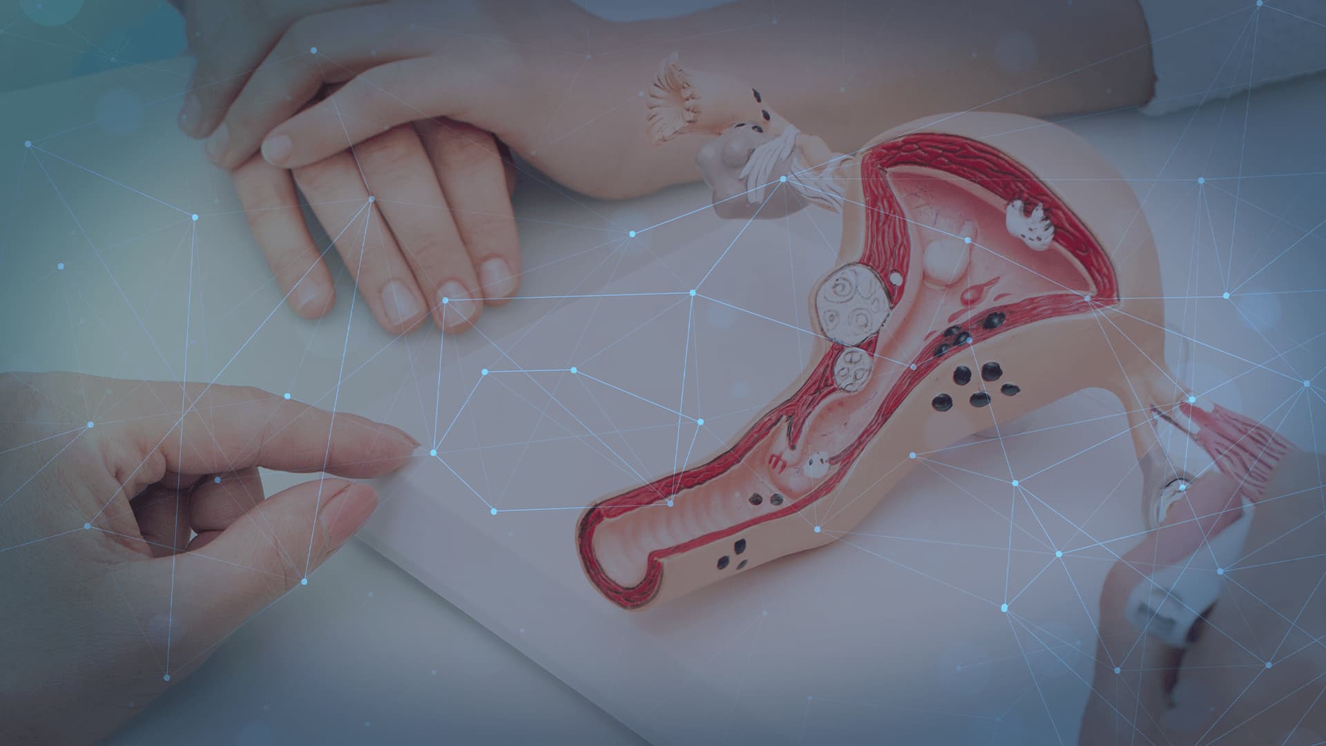 Actualizacion en SOP: Experiencia Clinica en México